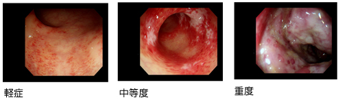 大腸肛門科 肛門外科 肛門科の港北肛門クリニック