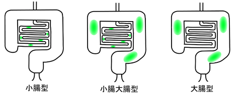 大腸肛門科 肛門外科 肛門科の港北肛門クリニック