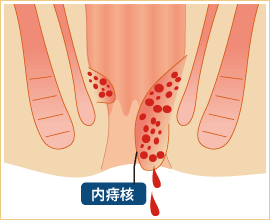 大腸肛門科 肛門外科 肛門科の港北肛門クリニック