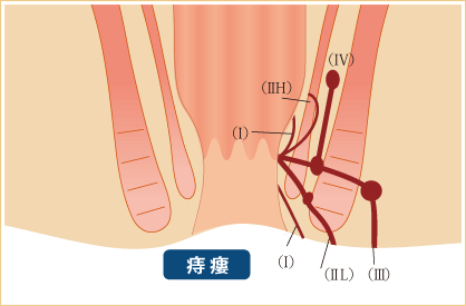 大腸肛門科 肛門外科 肛門科の港北肛門クリニック